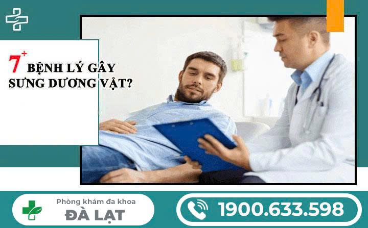 Hình ảnh minh họa